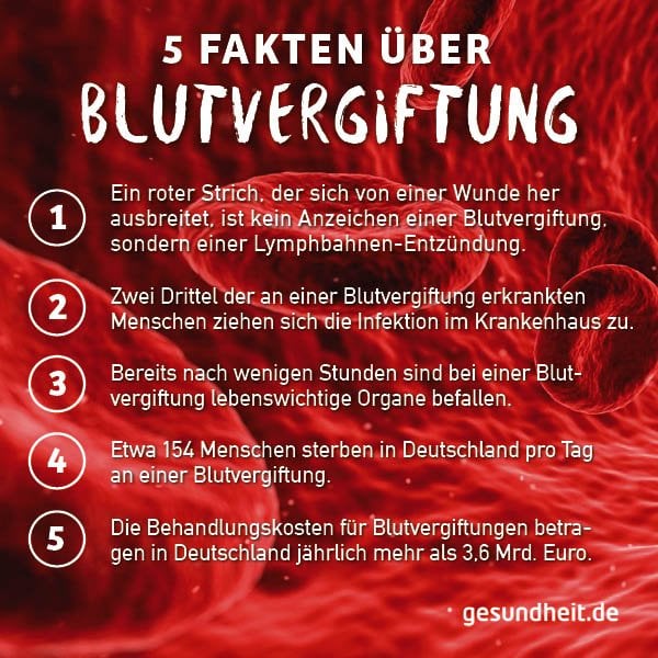 5 Fakten über Blutvergiftungen (Infografik)