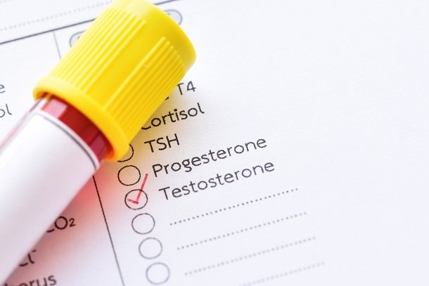 Testosteronmangel behandeln