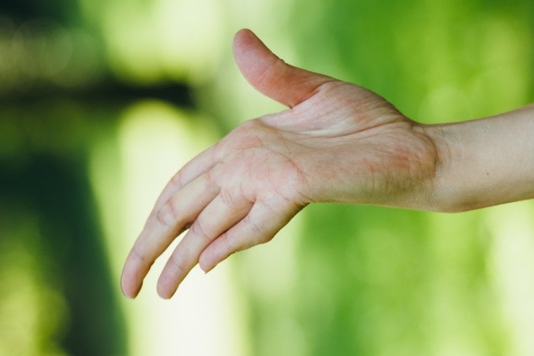 Hand einer Person mit Marfan-Syndrom