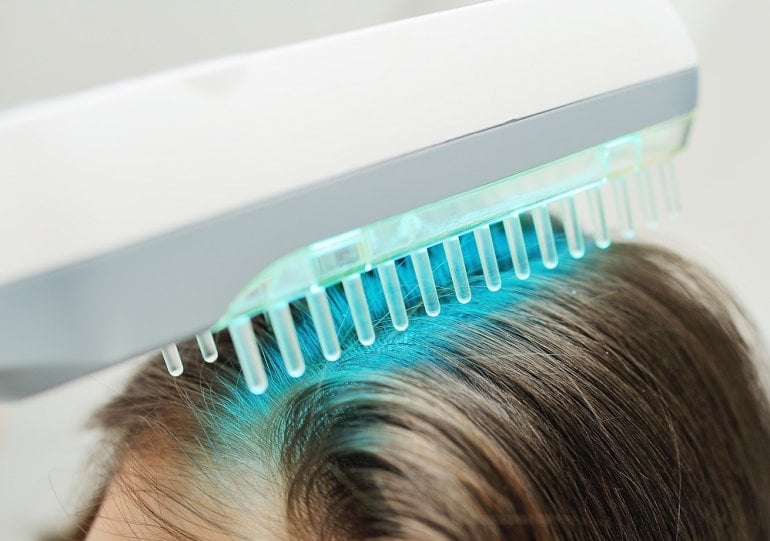 UV-Lichtkamm wird an Kopfhaut angewendet