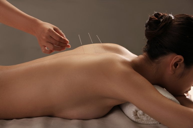 Akupunktur-Behandlung