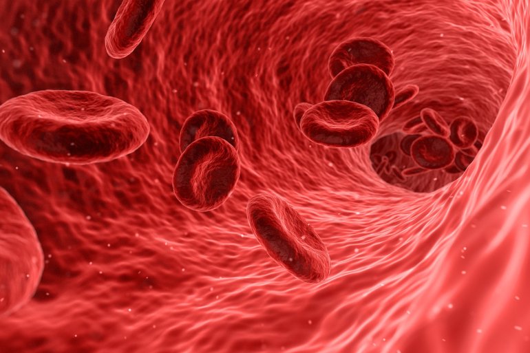 Aortenaneurysma  Blut in Aorta