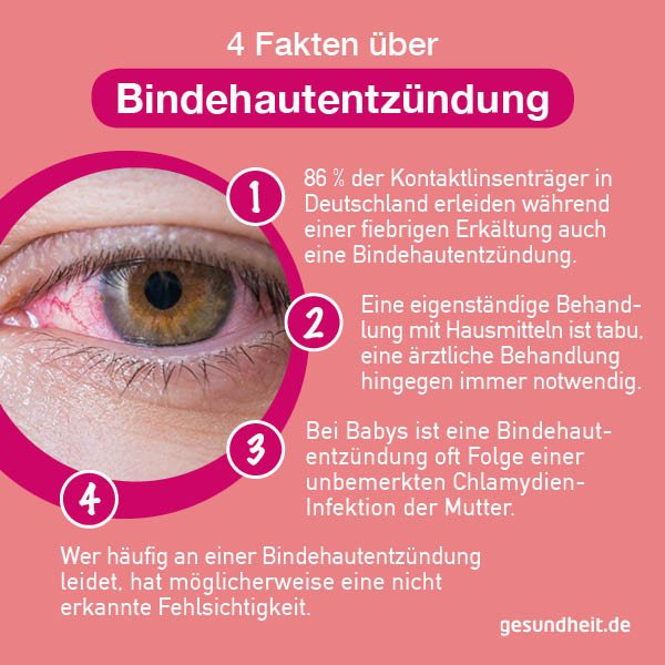 4 Fakten über Bindehautentzündungen (Infografik)