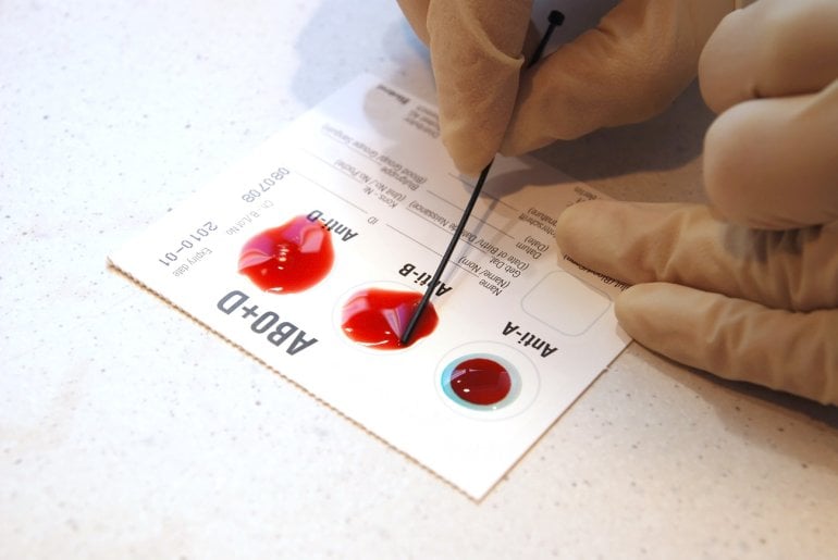 Blutgruppen-Test