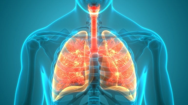 Lunge mit Bronchien bei COPD (Illustration)
