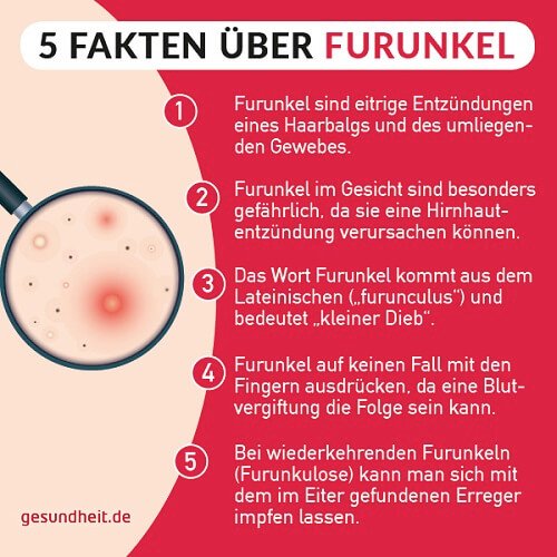 5 Fakten über Furunkel (Infografik)