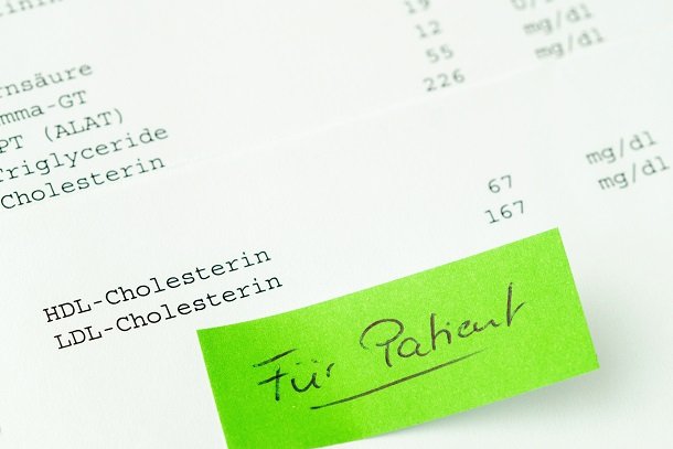 Cholesterinwerte: Zu hoch oder zu niedrig? Cholesterinwerte: Zu hoch oder zu niedrig?