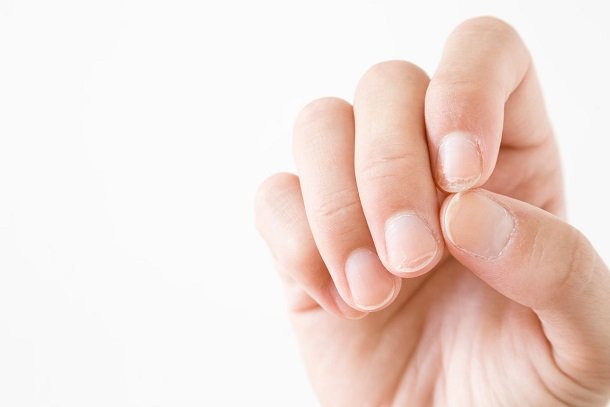 Obere Schicht des Nagels löst sich ab Obere Schicht des Nagels löst sich ab