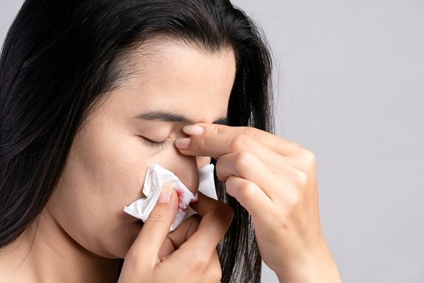 Nasenbluten bei Bluthochdruck häufig stärker