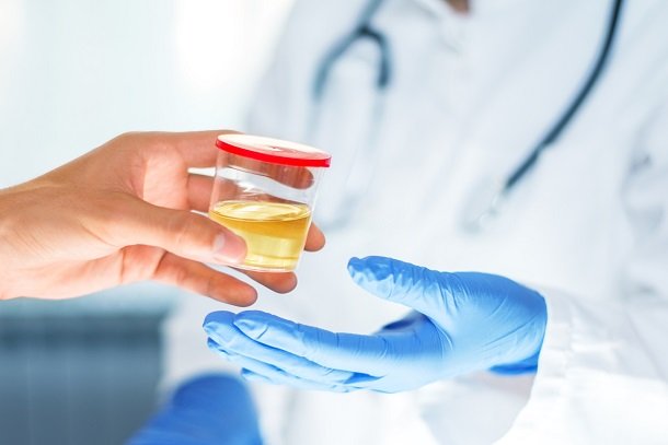 Blut im Urin bei Krebs Blut im Urin bei Krebs
