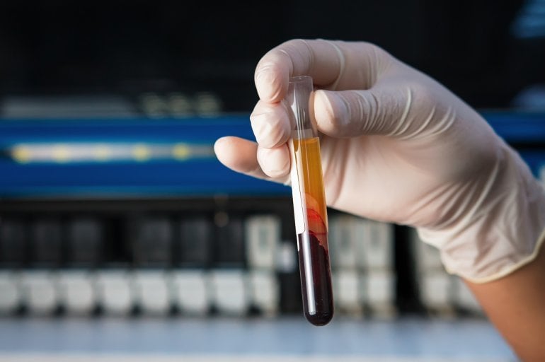 Zentrifugierte Blutprobe zur Bestimmung des Hämatokrit-Werts