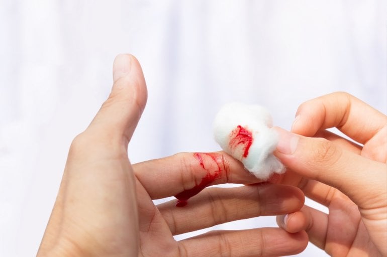 Mann mit Hämophilie blutet am Finger