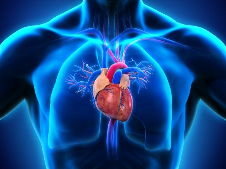 Herz mit koronarer Herzkrankheit KHK (Illustration)
