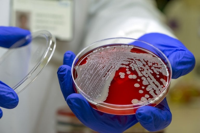 MRSA-Bakterien in Petrischale