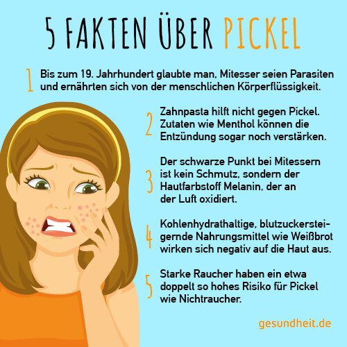 5 Fakten über Pickel (Infografik)