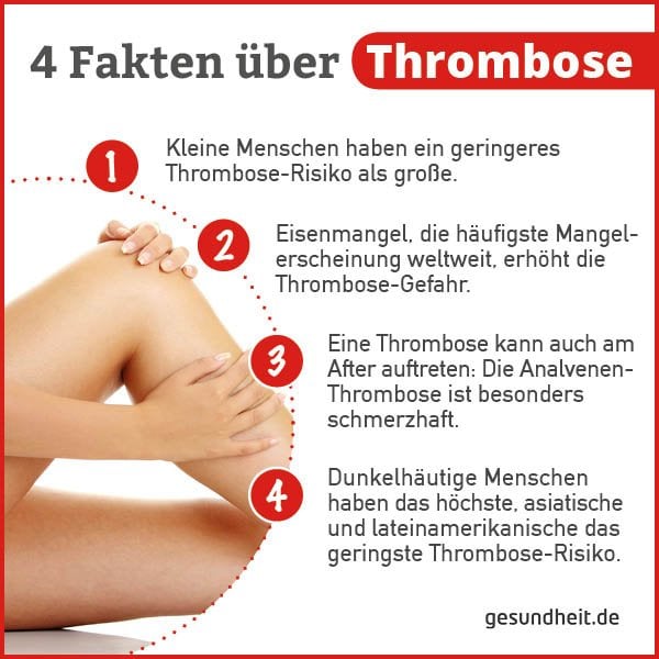 4 Fakten über Thrombose (Infografik)