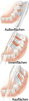 richtig Zähneputzen (Illustration)