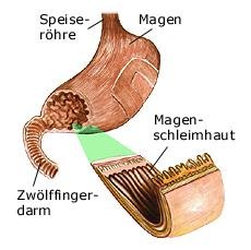 Magen (anatomische Illustration)