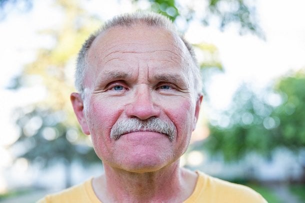 Rotes Gesicht als Symptom Rotes Gesicht als Symptom