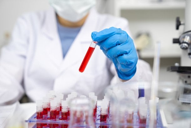 Wie schnell kann man Triglyceride senken? Wie schnell kann man Triglyceride senken?