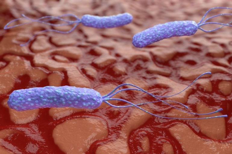 Helicobacter-pylori-Bakterien im Magen