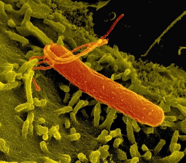 Helicobacter pylori Bakterium (elektronenmikroskopische Aufnahme)